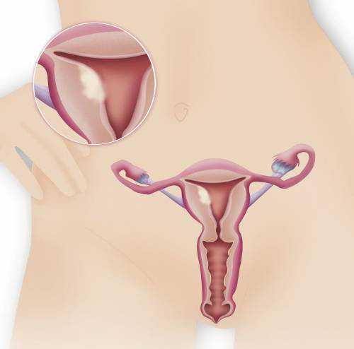 武汉供卵试管助孕中心助力失孤家庭重燃生育希望！